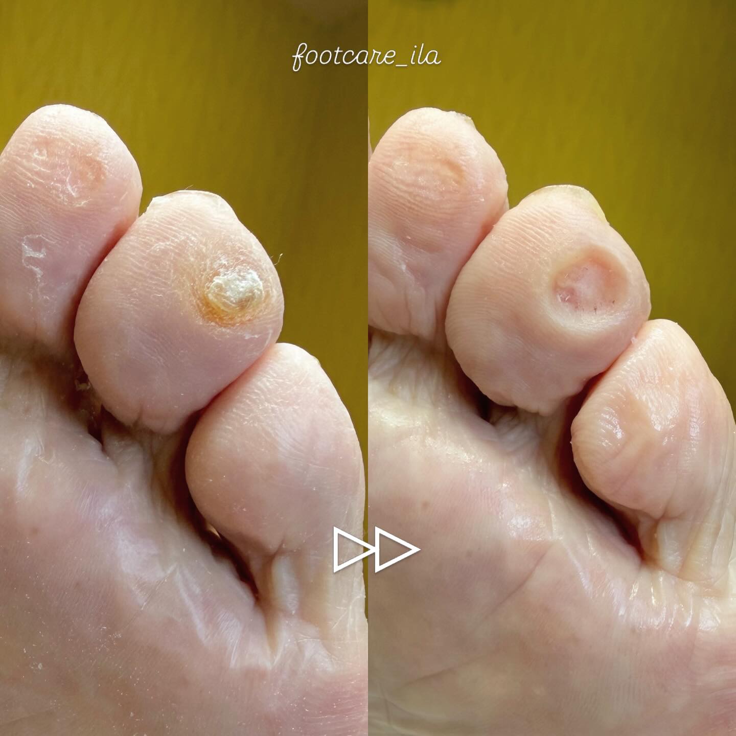 Instagramに投稿された画像