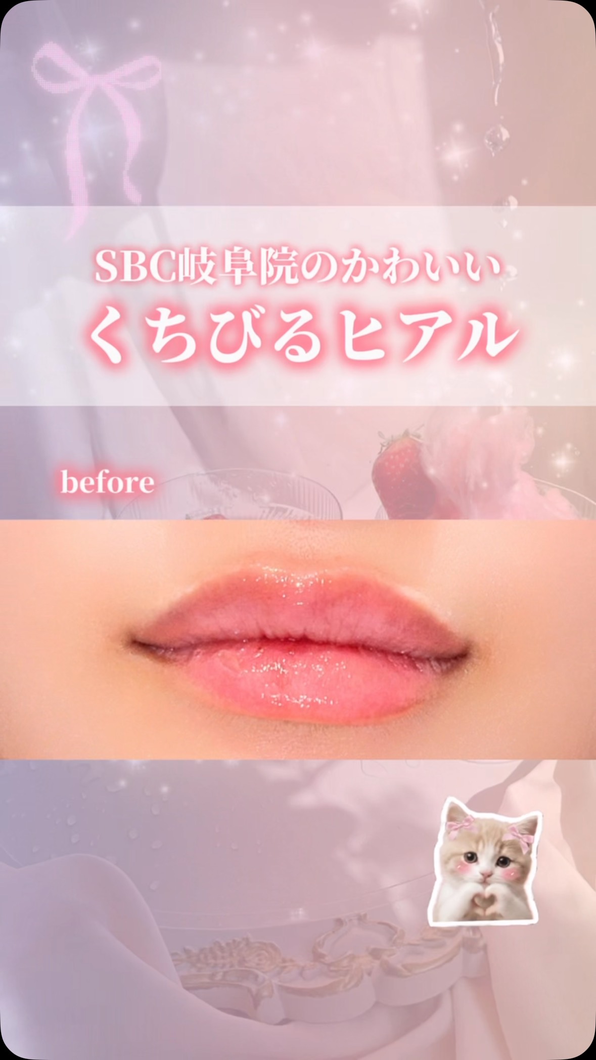 唇ヒアルで可愛くなれる😵💗
岐阜院のスタッフが唇のヒアルロン酸を受けました🥰
人中短縮効果で中顔面短縮するように仕上がりました👀💖
真顔でも微笑んでいるような明るい表情を作ることができます☺️✨
施術時間は30~40分程で当日からお化粧可能な施術なため、スケジュールを組みやすいことがメリットです!
薬剤:ボルベラXC 1cc
執刀医:近藤杏奈医師
リスク・副作用:稀に腫れや内出血の可能性
@sbc_gifu では、今よりもちょっと自信を持てる情報を配信中🌟
質問があればコメントに、
いいねや保存もお待ちしてます!
どこに行けばいいのか、何をしたらいいのか分からない。
岐阜院ではそんな方に寄り添ってカウンセリングをいたします。
ぜひ、一度お越しください☺️
✼••┈┈┈┈┈┈┈┈┈┈┈┈┈┈┈┈••✼
湘南美容クリニック岐阜院
〒500-8833
岐阜市神田町9丁目27 大岐阜ビル3階
診療時間 9:00-18:00
TEL☎️0120-541-470
#sbcヒアル